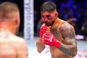 Ilias Topouria’s gruesome facial injuries revealed after brutal TKO loss Ilias Topouria's Gruesome Facial Injuries Revealed After Brutal Tko Loss