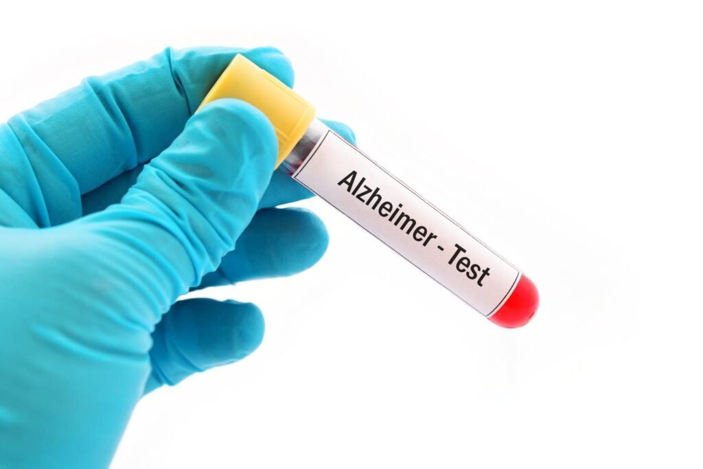 New Blood Tests For Alzheimer's Are Easy. But Do You